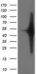 SETD7 Antibody in Western Blot (WB)