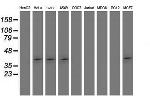 SETD7 Antibody in Western Blot (WB)