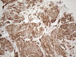 SETD8 Antibody in Immunohistochemistry (Paraffin) (IHC (P))