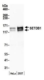 SETDB1 Antibody in Western Blot (WB)