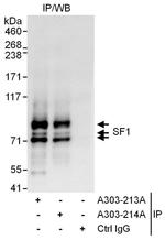 SF1 Antibody in Immunoprecipitation (IP)