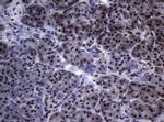 SF1 Antibody in Immunohistochemistry (Paraffin) (IHC (P))