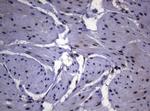 SF1 Antibody in Immunohistochemistry (Paraffin) (IHC (P))