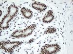 SF3A1 Antibody in Immunohistochemistry (Paraffin) (IHC (P))