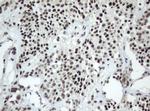 SF3A1 Antibody in Immunohistochemistry (Paraffin) (IHC (P))