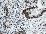 SF3A1 Antibody in Immunohistochemistry (Paraffin) (IHC (P))