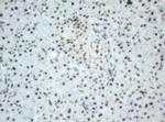 SF3A1 Antibody in Immunohistochemistry (Paraffin) (IHC (P))