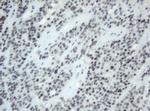 SF3A1 Antibody in Immunohistochemistry (Paraffin) (IHC (P))