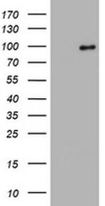 SF3A1 Antibody in Western Blot (WB)