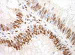 SF3A3 Antibody in Immunohistochemistry (IHC)