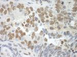 SF3A3 Antibody in Immunohistochemistry (IHC)