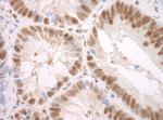 SF3A3 Antibody in Immunohistochemistry (IHC)