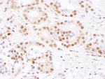 SF3B4 Antibody in Immunohistochemistry (IHC)