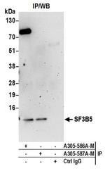 SF3B5 Antibody in Western Blot (WB)