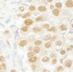 SFRS2IP Antibody in Immunohistochemistry (IHC)