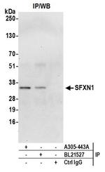 SFXN1 Antibody in Western Blot (WB)