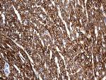 SGCD Antibody in Immunohistochemistry (Paraffin) (IHC (P))