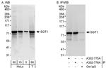 GCR2/SGT1 Antibody in Western Blot (WB)