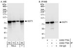 GCR2/SGT1 Antibody in Western Blot (WB)