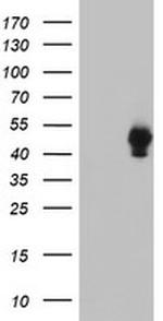 SH2D2A Antibody in Western Blot (WB)