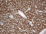 SH3BGR Antibody in Immunohistochemistry (Paraffin) (IHC (P))