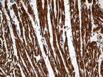 SH3BGR Antibody in Immunohistochemistry (Paraffin) (IHC (P))