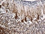 SH3BGR Antibody in Immunohistochemistry (Paraffin) (IHC (P))