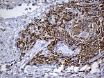 SH3BP1 Antibody in Immunohistochemistry (Paraffin) (IHC (P))