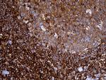 SH3BP1 Antibody in Immunohistochemistry (Paraffin) (IHC (P))