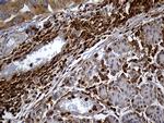 SH3BP1 Antibody in Immunohistochemistry (Paraffin) (IHC (P))