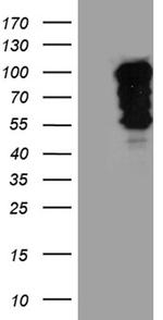 SH3BP1 Antibody in Western Blot (WB)