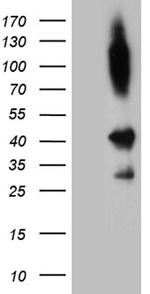 SHARPIN Antibody in Western Blot (WB)