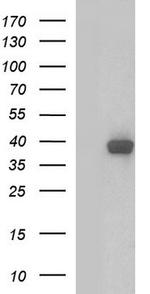 SHBG Antibody in Western Blot (WB)