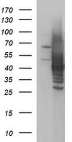 SHBG Antibody in Western Blot (WB)