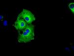 SHC1 Antibody in Immunocytochemistry (ICC/IF)