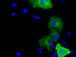 SHC1 Antibody in Immunocytochemistry (ICC/IF)