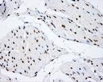 SHC1 Antibody in Immunohistochemistry (Paraffin) (IHC (P))