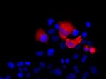 SHH Antibody in Immunocytochemistry (ICC/IF)