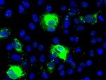 SHH Antibody in Immunocytochemistry (ICC/IF)