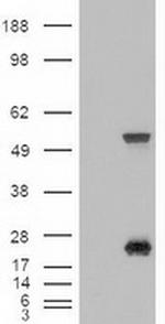 SHH Antibody in Western Blot (WB)