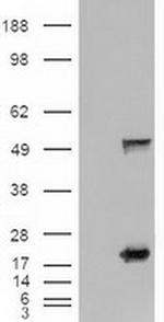 SHH Antibody in Western Blot (WB)