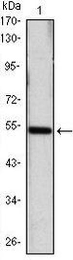 SHH Antibody in Western Blot (WB)