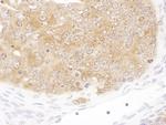 SHMT1 Antibody in Immunohistochemistry (IHC)