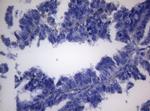 SHMT2 Antibody in Immunohistochemistry (Paraffin) (IHC (P))