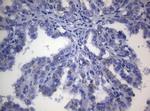 SHMT2 Antibody in Immunohistochemistry (Paraffin) (IHC (P))