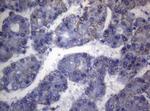 SHMT2 Antibody in Immunohistochemistry (Paraffin) (IHC (P))