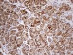 SHMT2 Antibody in Immunohistochemistry (Paraffin) (IHC (P))