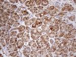 SHMT2 Antibody in Immunohistochemistry (Paraffin) (IHC (P))