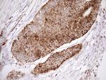 SHMT2 Antibody in Immunohistochemistry (Paraffin) (IHC (P))