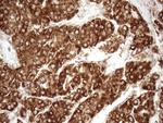 SHMT2 Antibody in Immunohistochemistry (Paraffin) (IHC (P))